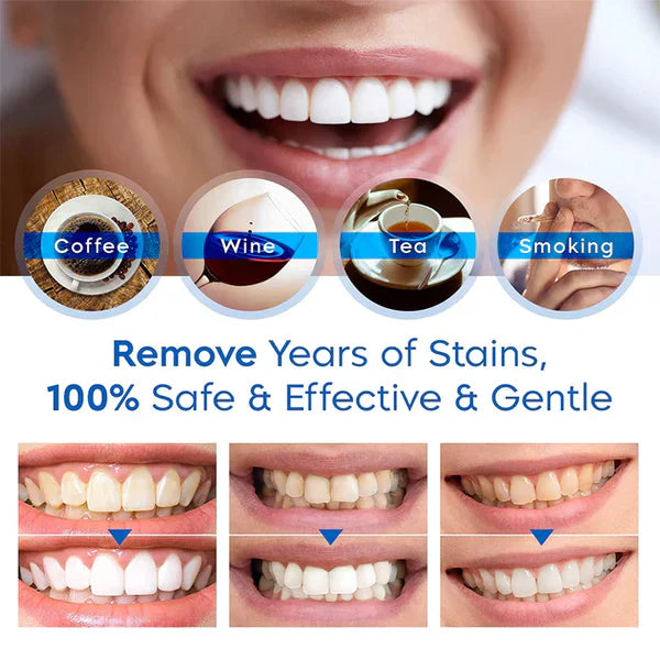 PEARLI Teeth Whitening Pen
