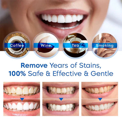 PEARLI Teeth Whitening Pen